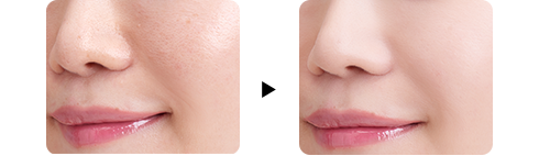 乾燥さん クリームしっとり感